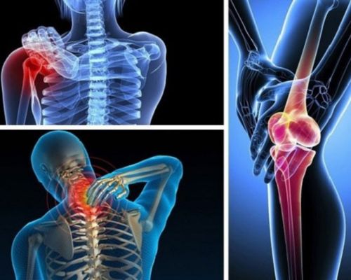 7 loại thuốc Đông y chữa xương khớp cực kỳ hiệu quả