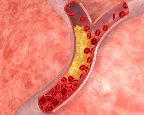 Cholesterol toàn phần – Hiểu rõ hơn về bản chất của cholesterol