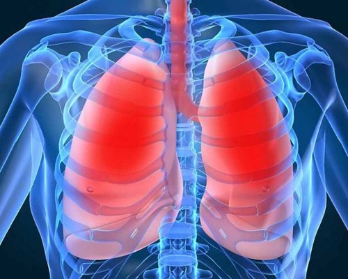 Những lưu ý khi điều trị lao phổi tại nhà cần ghi nhớ