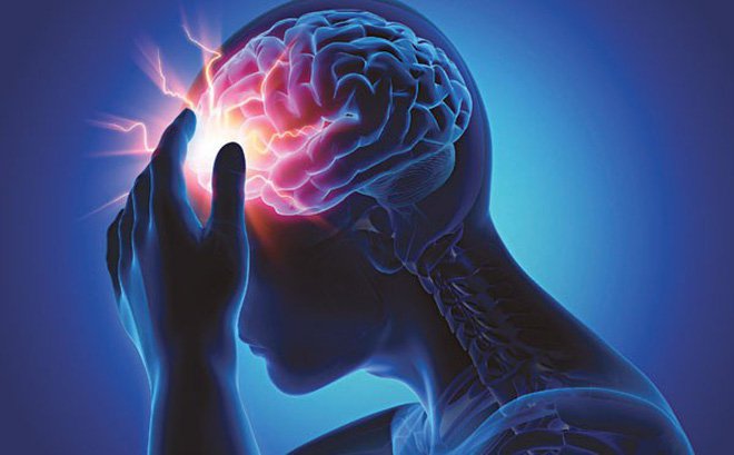 Tai biến mạch máu não: bệnh lý nguy hiểm ai cũng cần phải biết để xử trí kịp thời