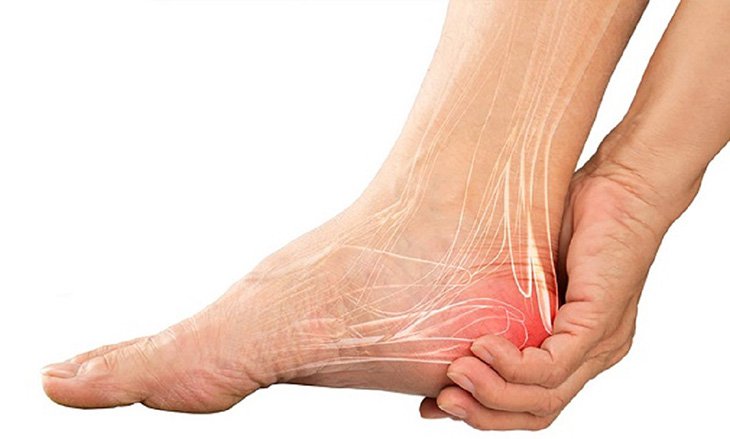 Cách chữa đau gót chân bằng phương pháp dân gian